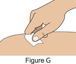 Figure G