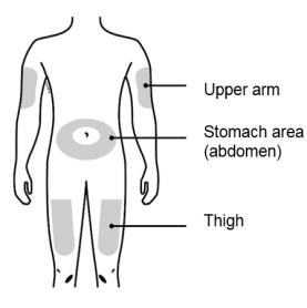 Clean your injection site with an alcohol wipe. Let your skin dry.