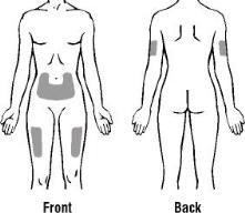 Step 4: Choosing and Preparing an Injection Site 