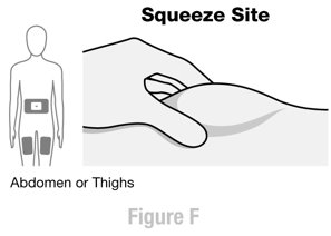 Instructions for Use Figure F