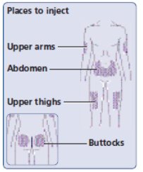 Figure I: Injection sites