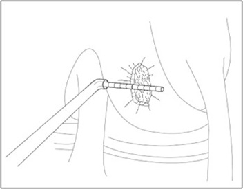 Measure Defect