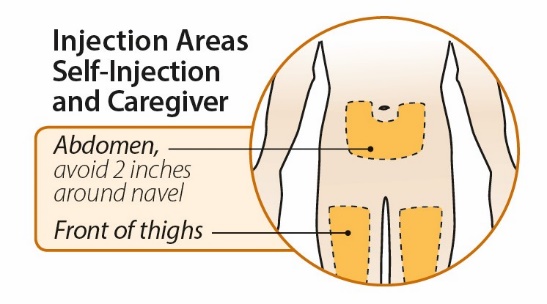 injection_areas